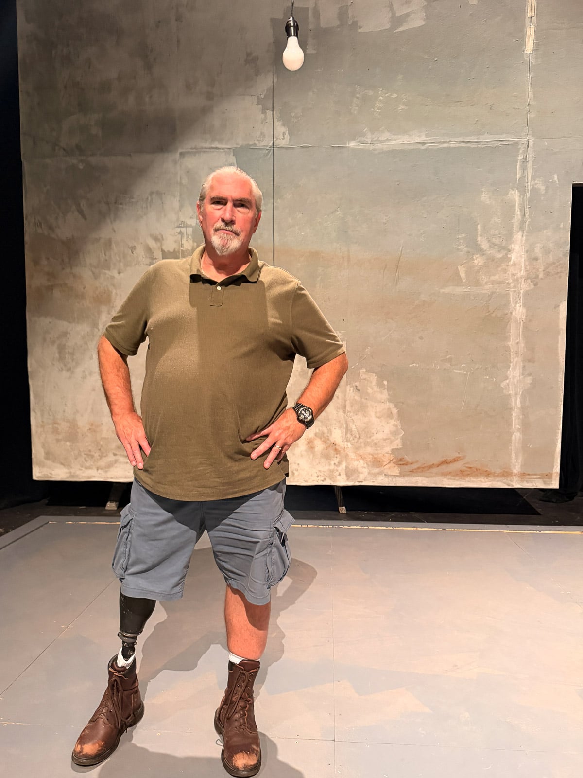 Man with one prosthetic leg standing with hands on hips